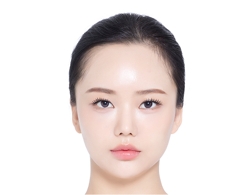 Incision hair transplant before