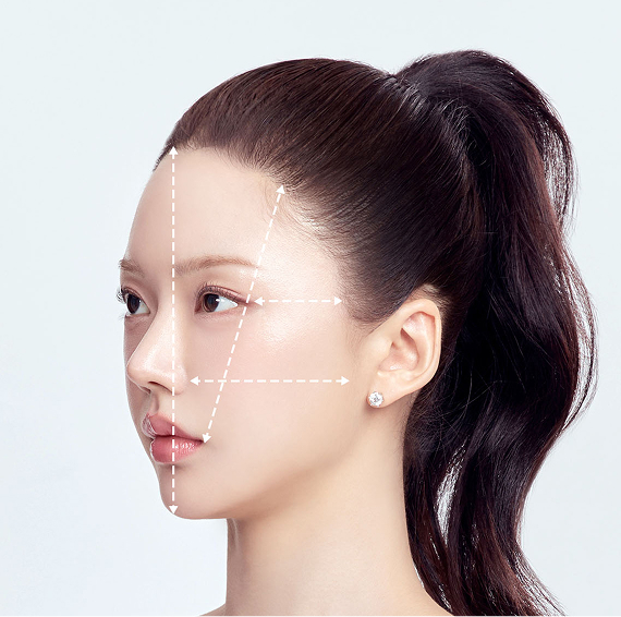 측면비율