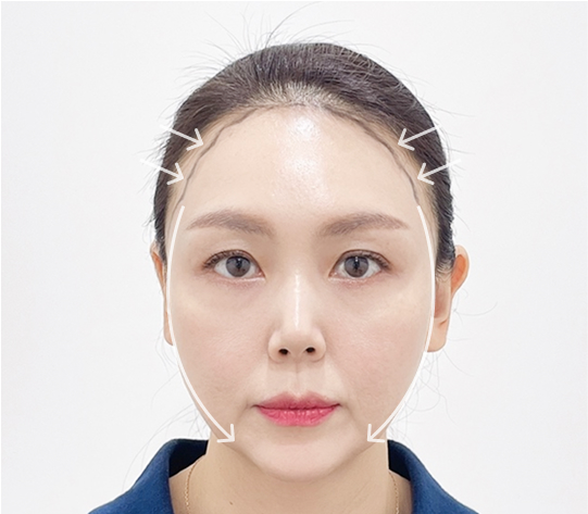 둥근 얼굴형